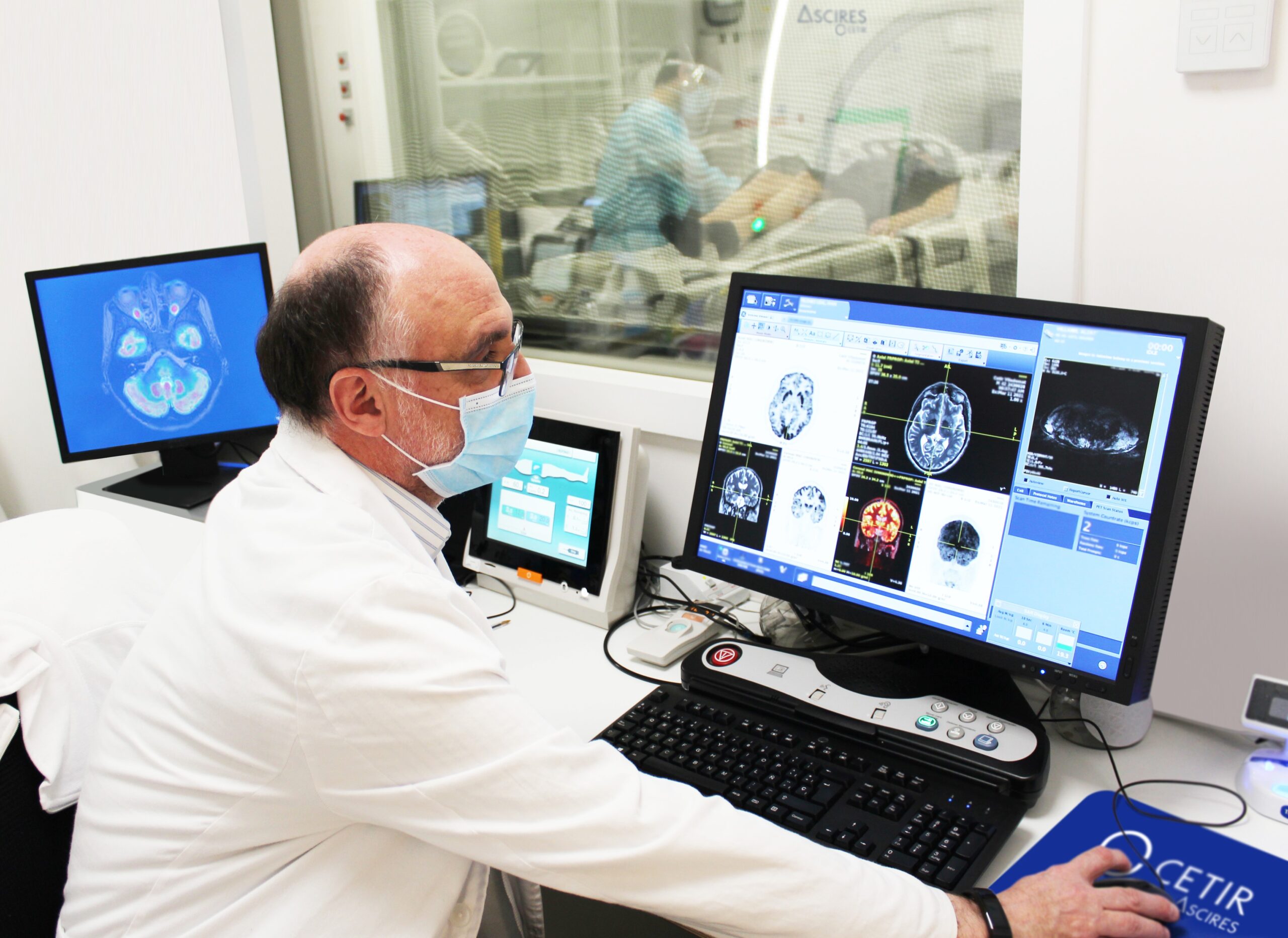 El Alzheimer y su diagnóstico precoz inspiran el tándem de precisión biomarcadores e inteligencia artificial