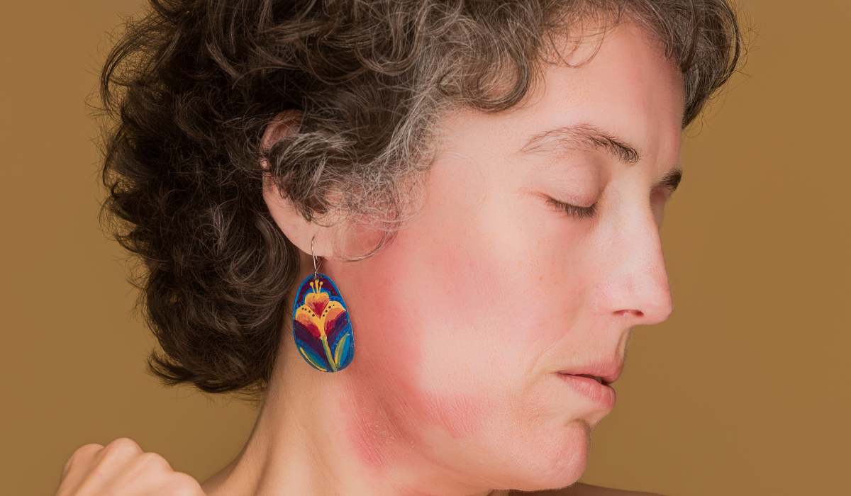 El virus de Epstein-Barr causa principal del lupus eritematoso sistémico