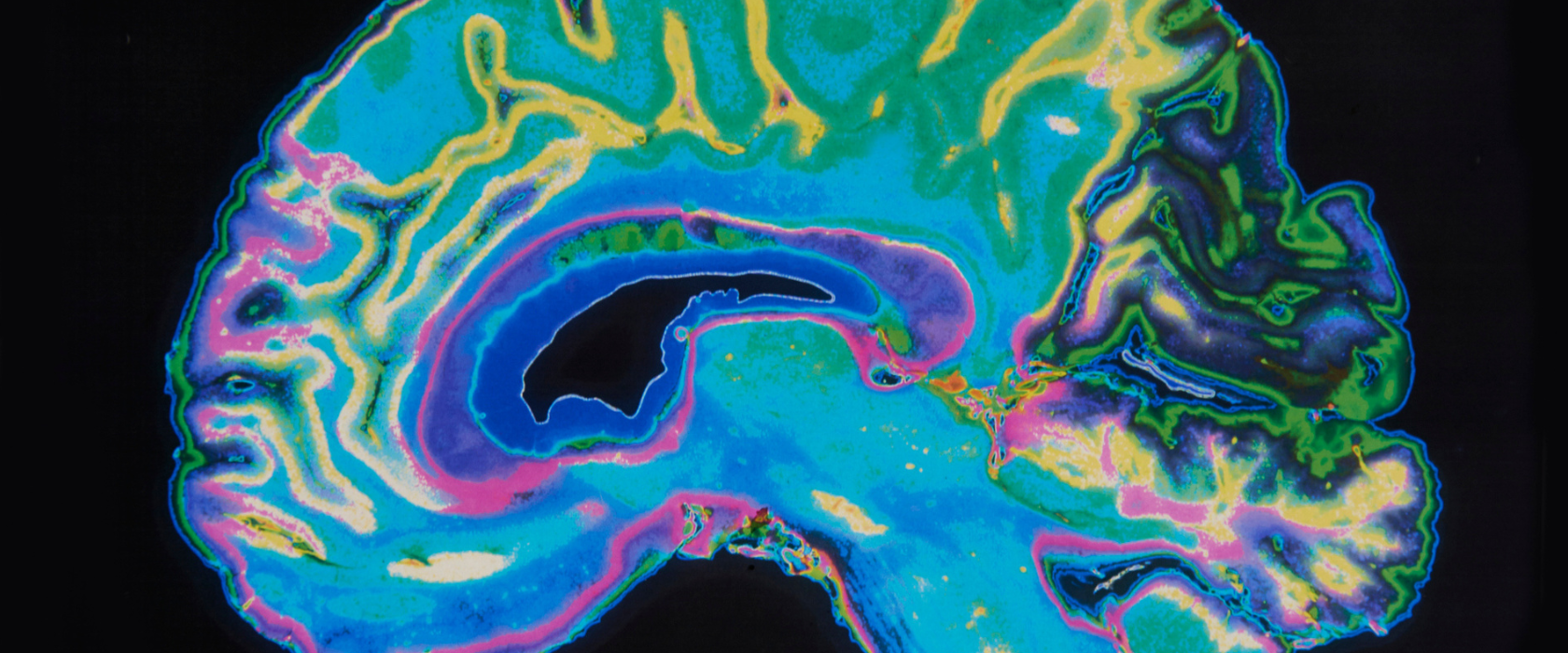 <?php echo pulse_output(); ?>