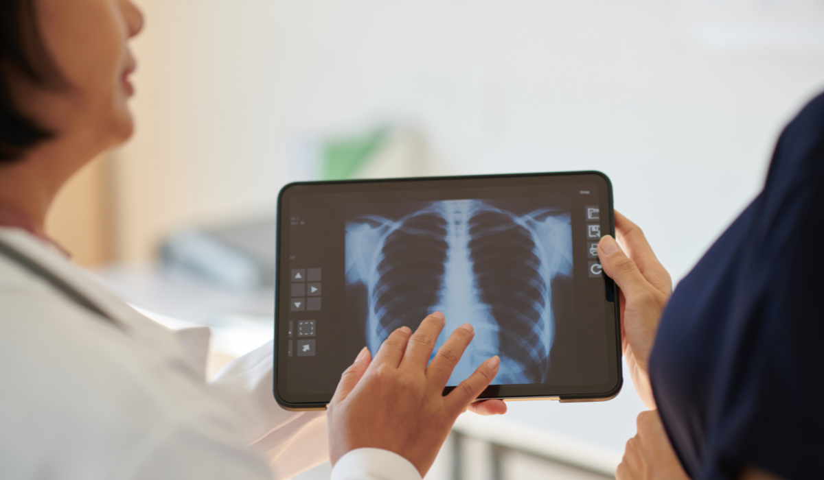 Un modelo de riesgo personalizado para mejorar el diagnóstico precoz del cáncer de pulmón (1)