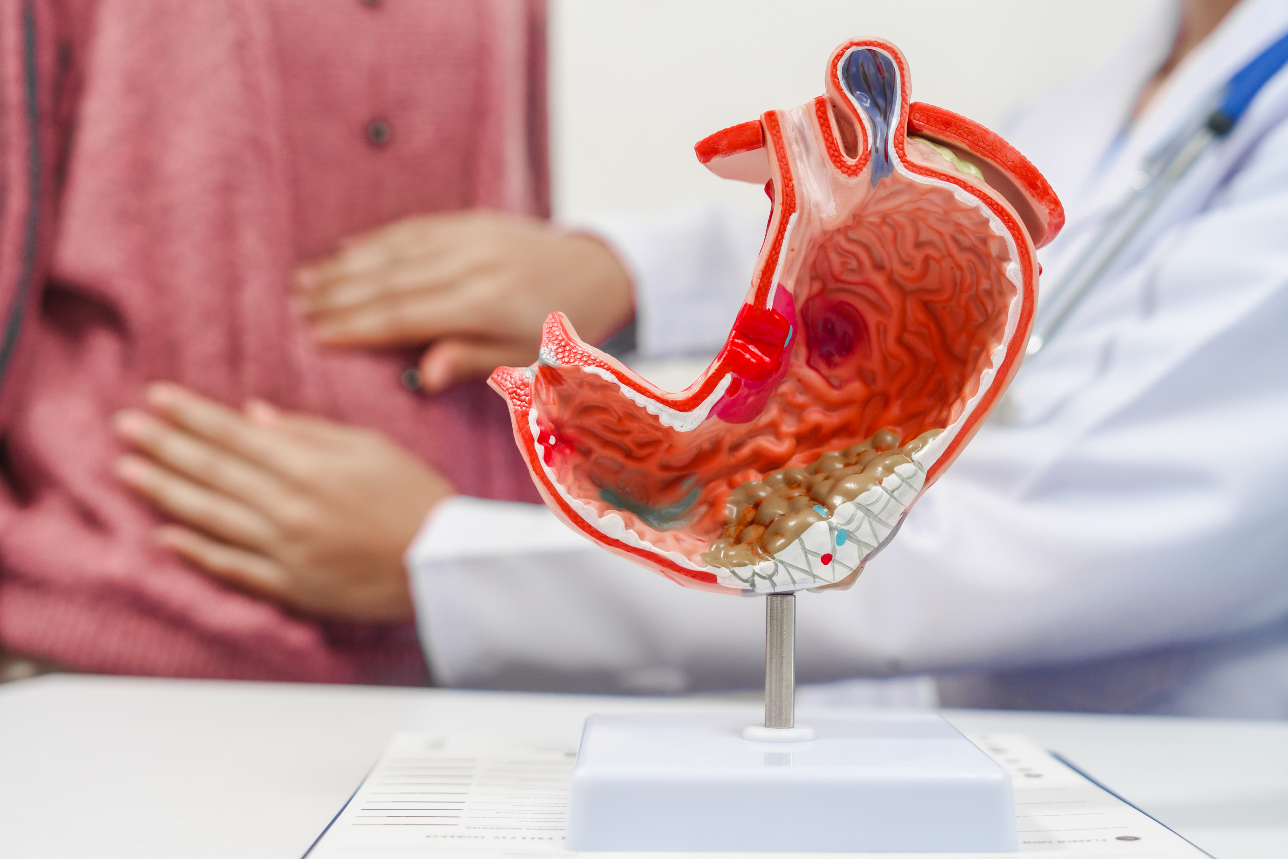 Cáncer-de-estómago-FQUAES